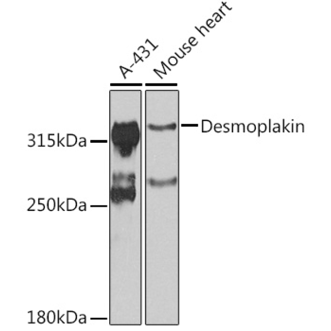 Desmoplakin Rabbit Polyclonal Antibody