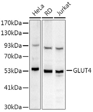 GLUT4 Rabbit Polyclonal Antibody