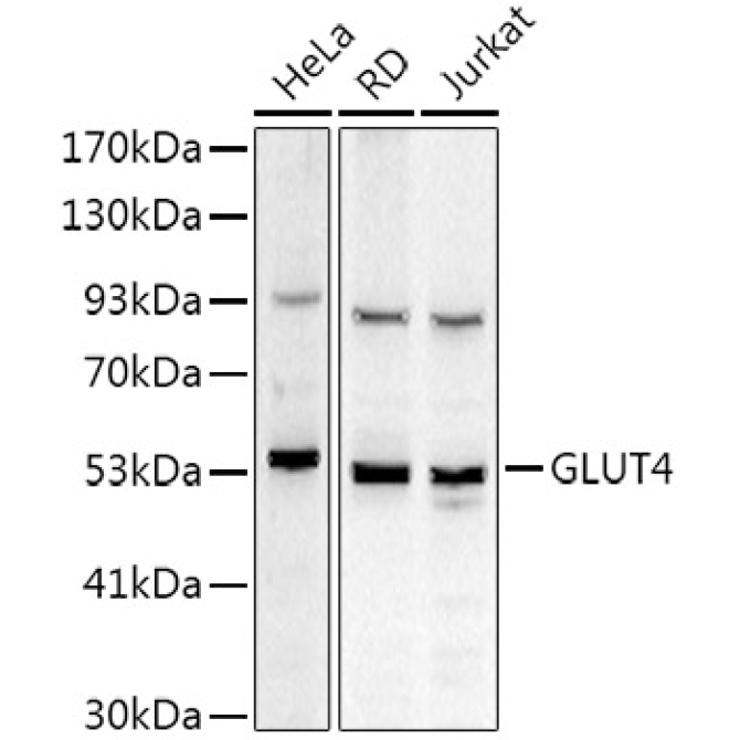 GLUT4 Rabbit Polyclonal Antibody