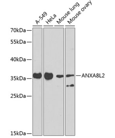 ANXA8L2 Rabbit Polyclonal Antibody