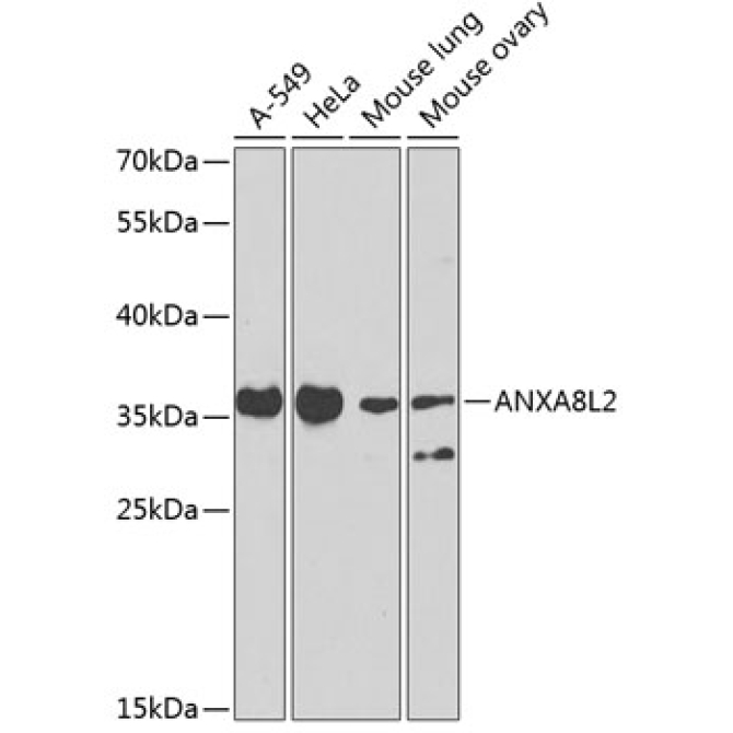 ANXA8L2 Rabbit Polyclonal Antibody