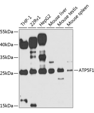 ATP5F1 Rabbit Polyclonal Antibody