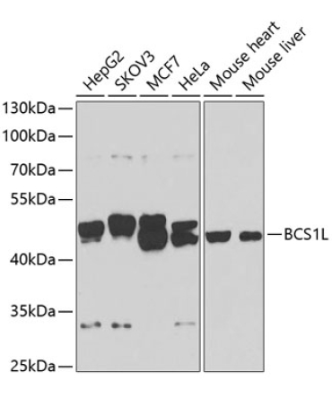 BCS1L Rabbit Polyclonal Antibody