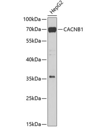 CACNB1 Rabbit Polyclonal Antibody