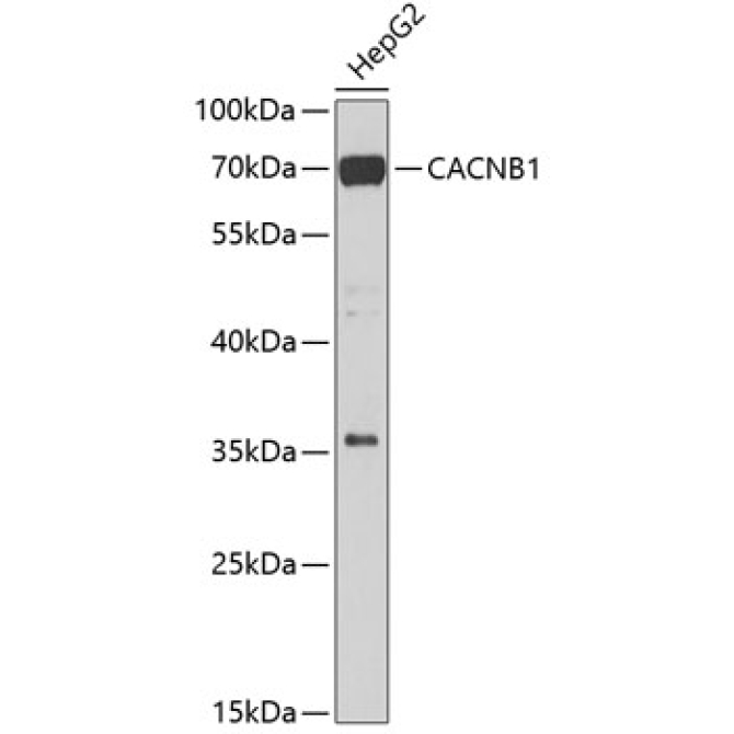 CACNB1 Rabbit Polyclonal Antibody