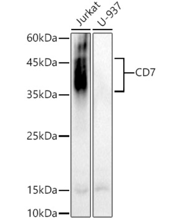 CD7 Rabbit Polyclonal Antibody