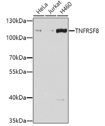 CD30 Rabbit Polyclonal Antibody