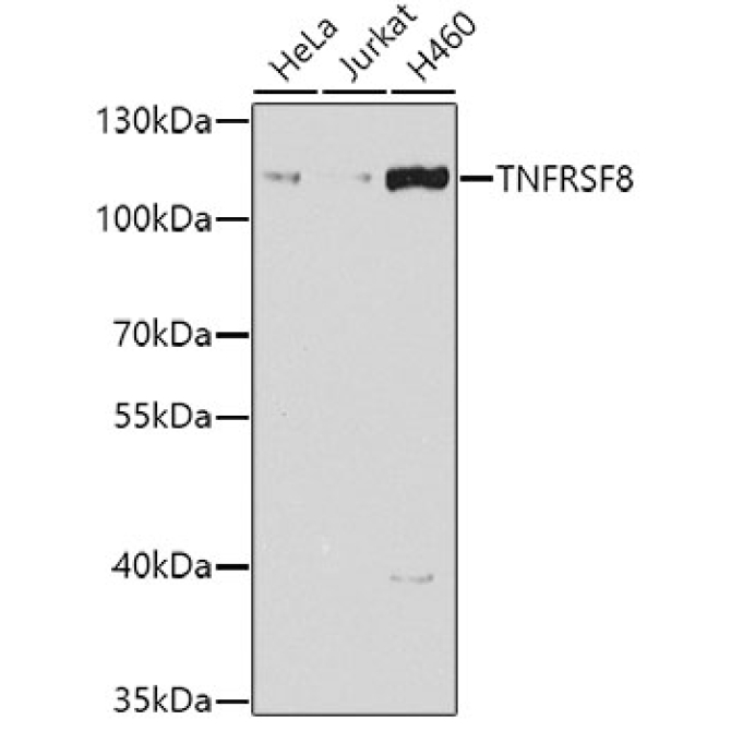 CD30 Rabbit Polyclonal Antibody