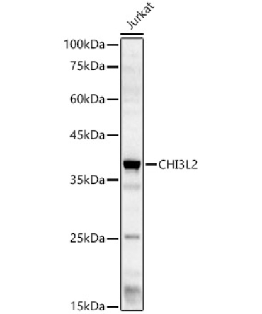 CHI3L2 Rabbit Polyclonal Antibody
