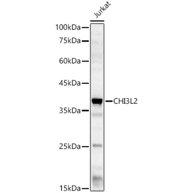 CHI3L2 Rabbit Polyclonal Antibody