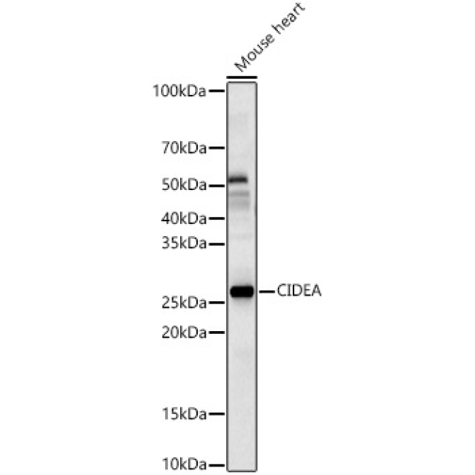 CIDEA Rabbit Polyclonal Antibody