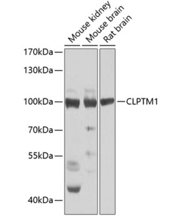 CLPTM1 Rabbit Polyclonal Antibody