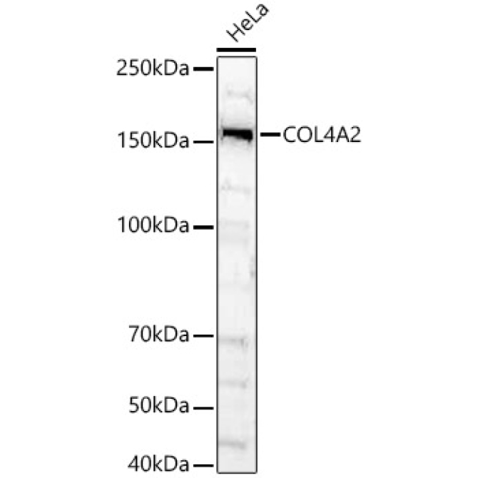 COL4A2 Rabbit Polyclonal Antibody