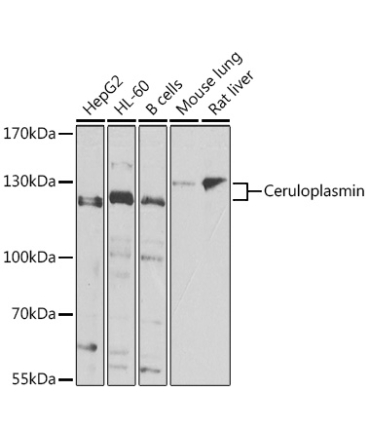 Ceruloplasmin Rabbit Polyclonal Antibody