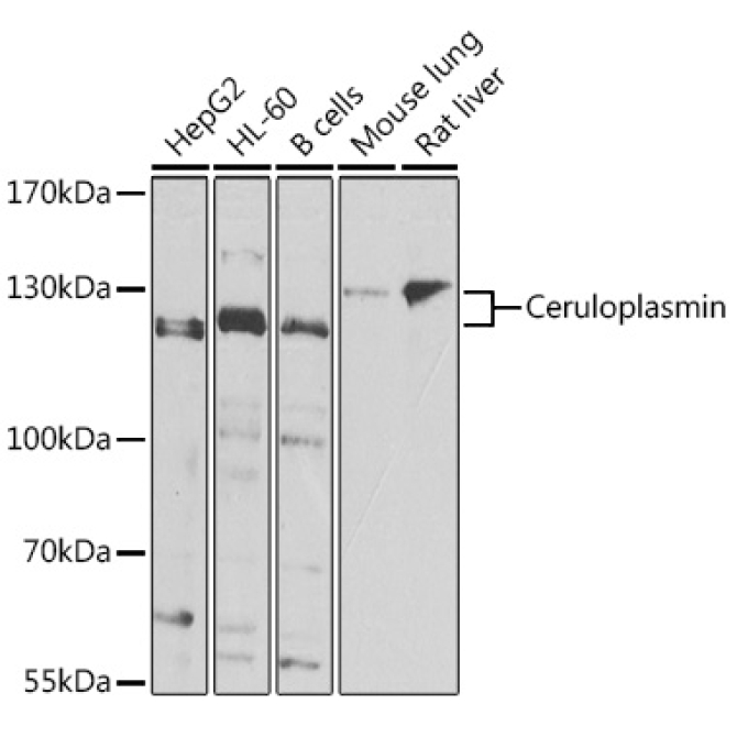 Ceruloplasmin Rabbit Polyclonal Antibody