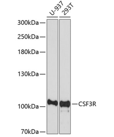 CSF3R Rabbit Polyclonal Antibody