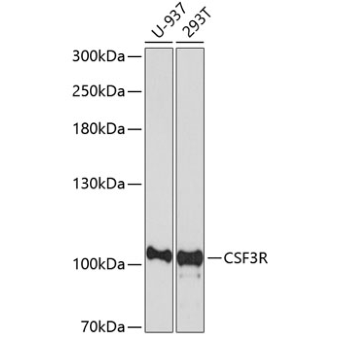 CSF3R Rabbit Polyclonal Antibody