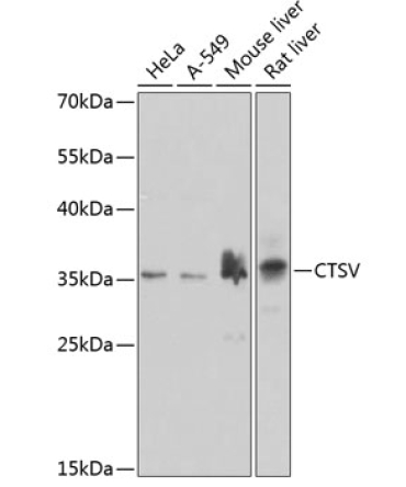 CTSV Rabbit Polyclonal Antibody