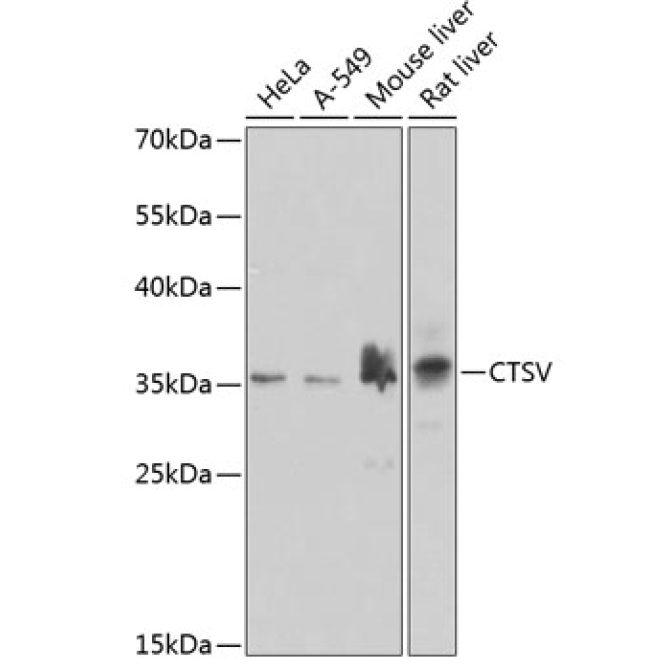 CTSV Rabbit Polyclonal Antibody