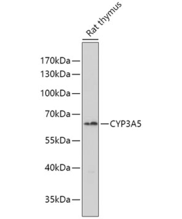 CYP3A5 Rabbit Polyclonal Antibody