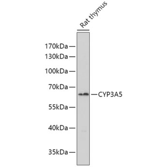 CYP3A5 Rabbit Polyclonal Antibody