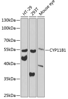 CYP11B1 Rabbit Polyclonal Antibody