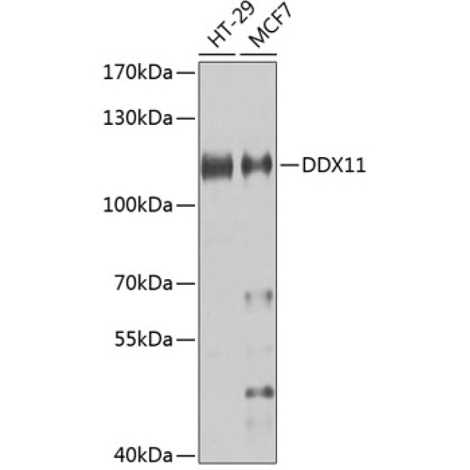 DDX11 Rabbit Polyclonal Antibody