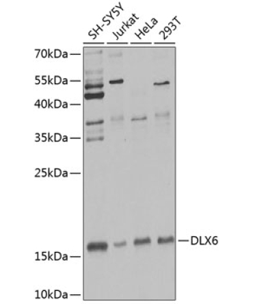 DLX6 Rabbit Polyclonal Antibody