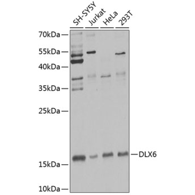 DLX6 Rabbit Polyclonal Antibody