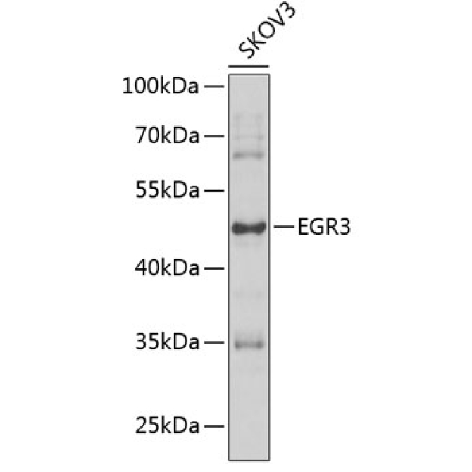 EGR3 Rabbit Polyclonal Antibody