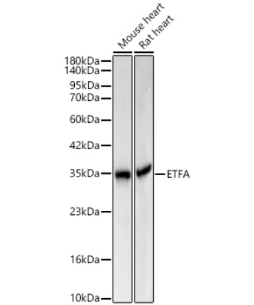 ETFA Rabbit Polyclonal Antibody