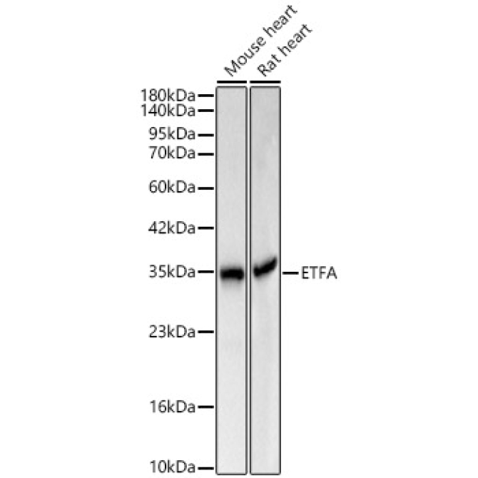 ETFA Rabbit Polyclonal Antibody
