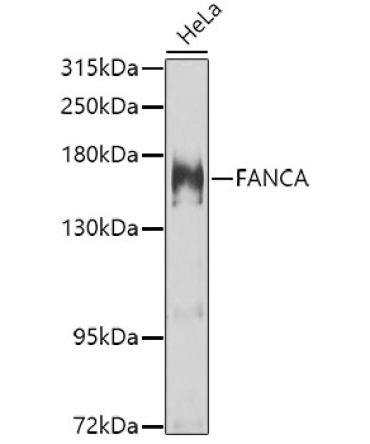 FANCA Rabbit Polyclonal Antibody