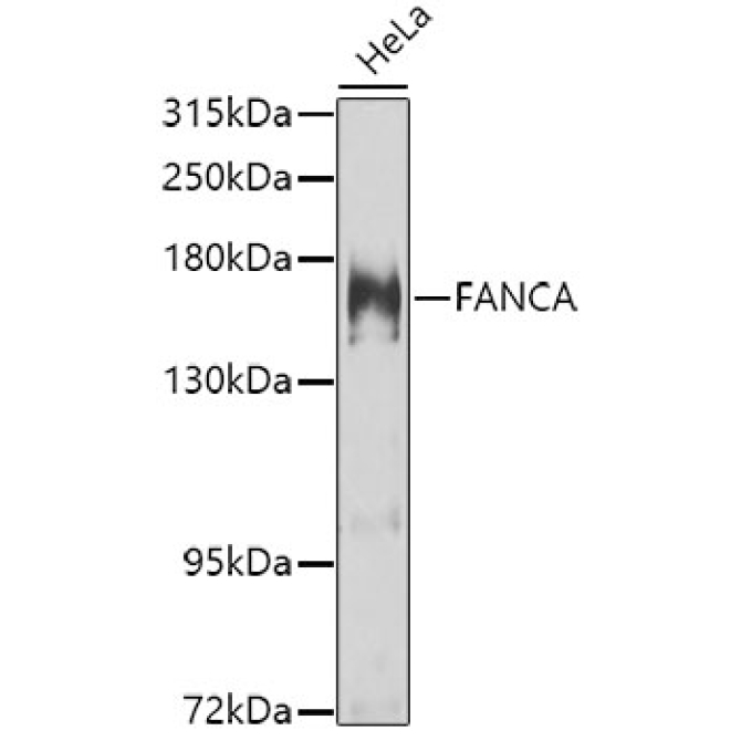 FANCA Rabbit Polyclonal Antibody