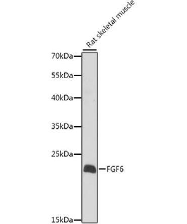 FGF6 Rabbit Polyclonal Antibody