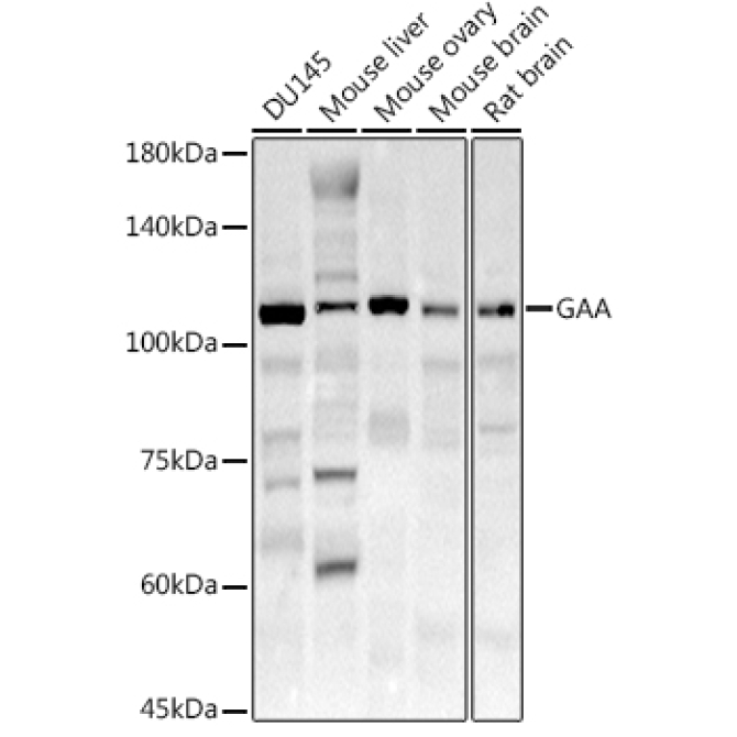 GAA Rabbit Polyclonal Antibody
