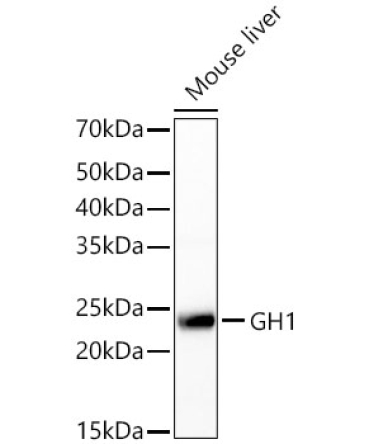 GH1 Rabbit Polyclonal Antibody
