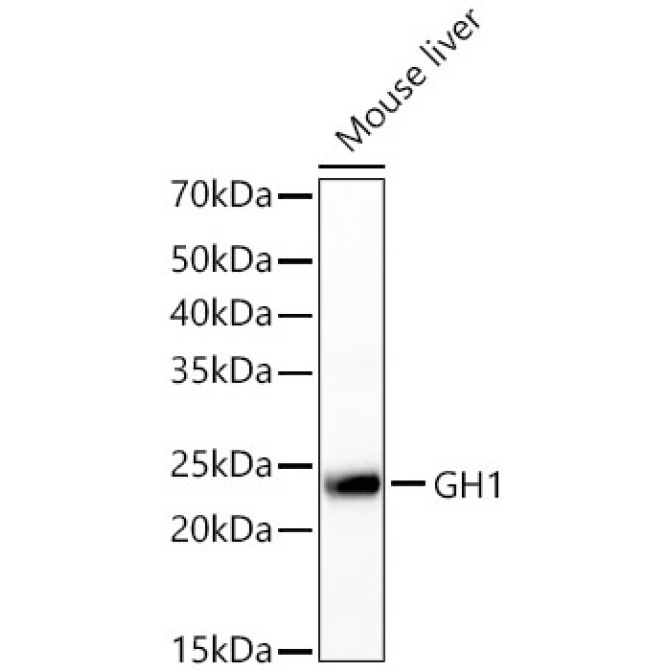 GH1 Rabbit Polyclonal Antibody