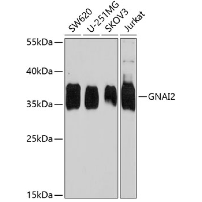 GNAI2 Rabbit Polyclonal Antibody