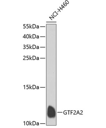 GTF2A2 Rabbit Polyclonal Antibody