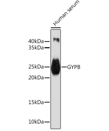 GYPB Rabbit Polyclonal Antibody