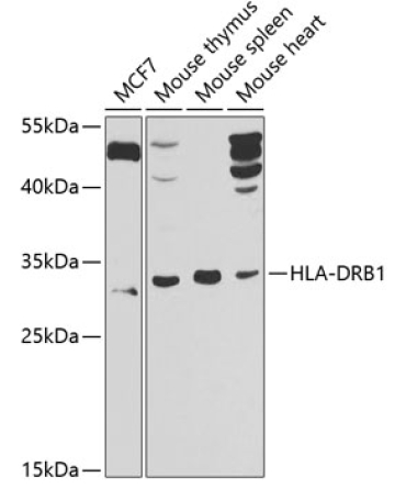 HLA-DRB1 Rabbit Polyclonal Antibody