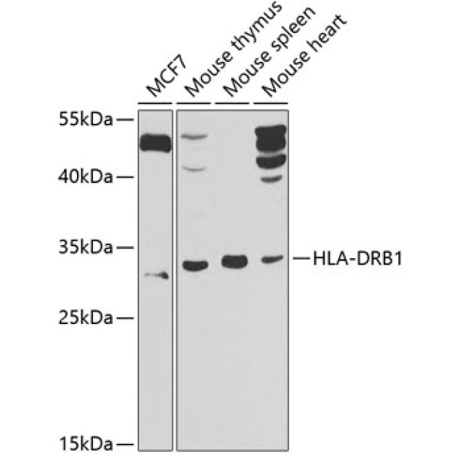 HLA-DRB1 Rabbit Polyclonal Antibody
