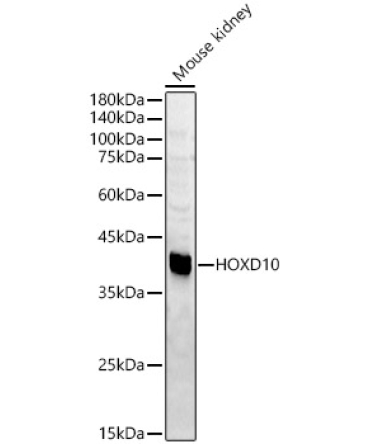 HOXD10 Rabbit Polyclonal Antibody