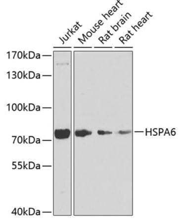 HSPA6 Rabbit Polyclonal Antibody