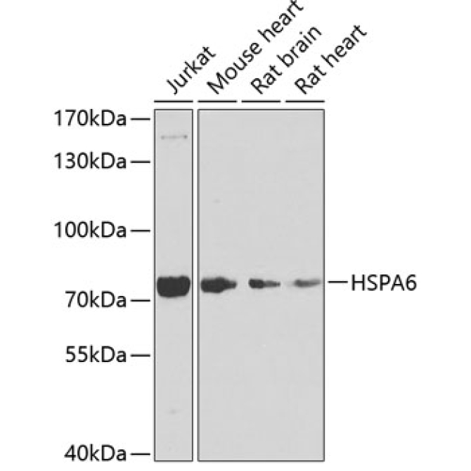 HSPA6 Rabbit Polyclonal Antibody