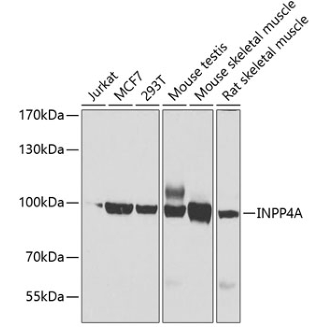 INPP4A Rabbit Polyclonal Antibody