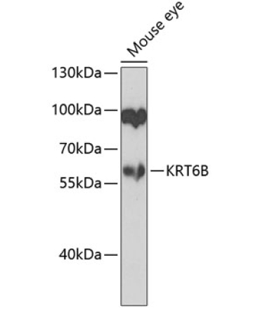 KRT6B Rabbit Polyclonal Antibody