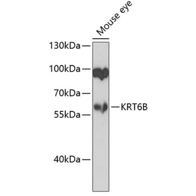 KRT6B Rabbit Polyclonal Antibody