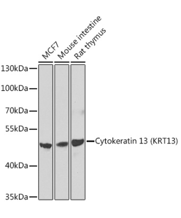 Cytokeratin 13 (KRT13) Rabbit Polyclonal Antibody